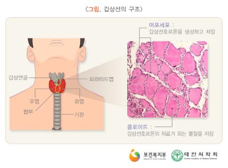 여포세포 : 갑상선호르몬을 생성하고 저장, 콜로이드 : 갑상선호르몬의 재료가 되는 물질을 저장